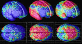 دانلود تحقیق  تصويربرداري از مغز در هنگام درد