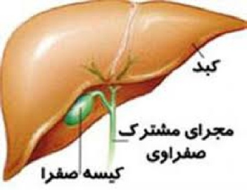 دانلود پاورپوینت کله سیستیت