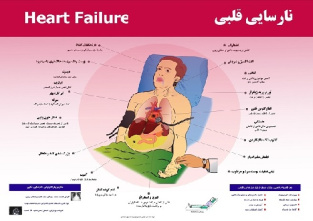 پوستر نارسایی قلبی یا CHF