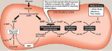 نقص آنزیمی در اریتروسیت ( -PD A G-6)
