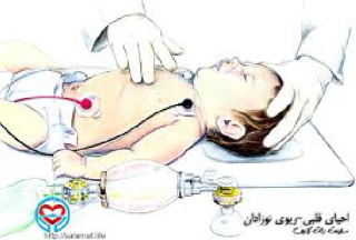 CPR شیرخواران و کودکان