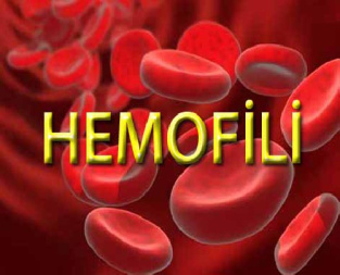 هموفیلی - Hemophilia