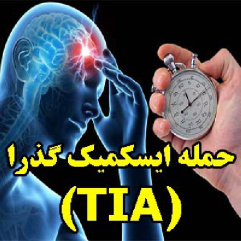 حمله‌ ايسكميك‌ گذرا (TIA)