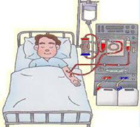 پاورپوینت در مورد دیالیز