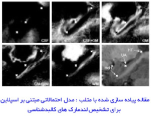 مقاله پیاده سازی شده با متلب : مدل احتمالاتی مبتنی بر اسپلاین برای تشخیص لندمارک های کالبدشناسی