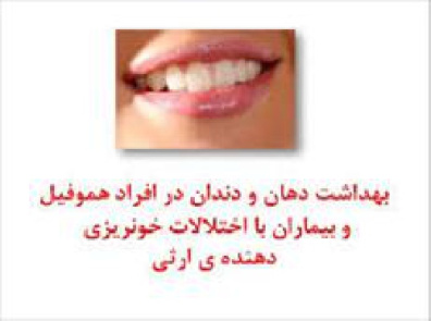پاورپوینت بهداشت دهان و دندان در بیماران هموفیلی