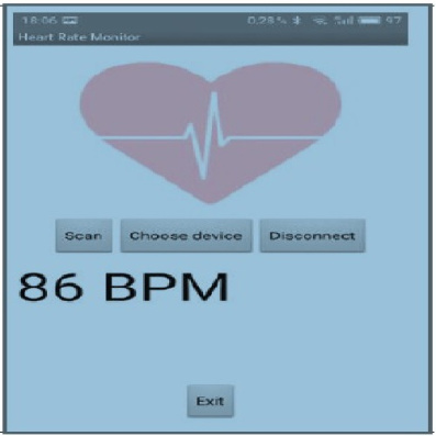 طراحی اپلیکیشنی برای اندازه گیری و نمایش ضربان قلب به کمک برد آردوینوی مجهز به ماژول بلوتوث بدون نیاز به دانش برنامه نویسی اندروید به کمک نرم افزار MIT