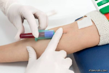 دانلود پاورپوینت آزمایش خون با تخفیف ویژه تک تاز