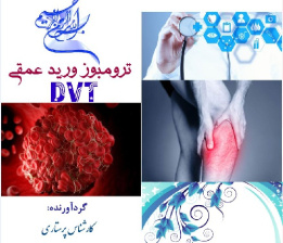 پمفلت (بروشور) آموزشی ترومبوز ورید عمقی (DVT)