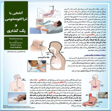 پوستر بیمارستانی آشنایی با تراکئوستومی و پگ در بیماران ICU