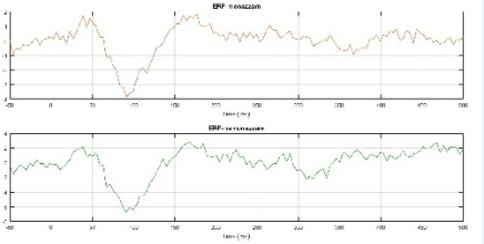 استخراج پتانسیلهای برانگیخته ناشی از تحریک از سیگنال EEG