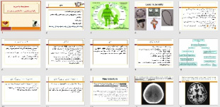 پاورپوینت با عنوان مسمومیت با سرب ، پاتوفیزیولوژی ، تشخیص و درمان