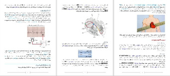 تحقیق با عنوان الکتروکاردیوگراف ( electrocardiograph (ECG