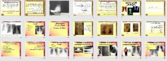 پاورپوينت با عنوان تفسیر تصاویر رادیوگرافی