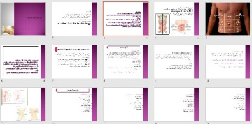 پاورپوينت با عنوان شکم حاد Acute Abdomen