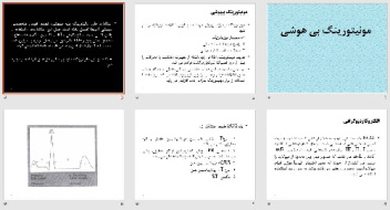 پاورپوينت با عنوان مونیتورینگ بی هوشی