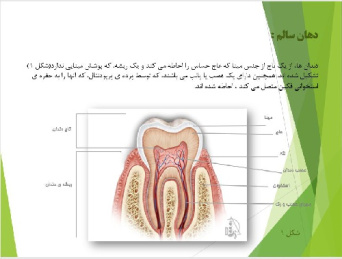 پاورپوينت با عنوان بهداشت دهان و دندان در افراد هموفیل و بیماران با اختلالات خونریزی دهنده ی ارثی