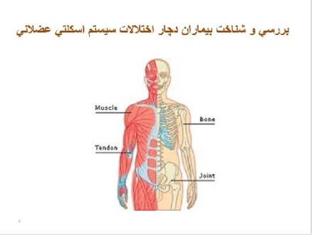 پاورپوينت با عنوان بررسي و شناخت بيماران دچار اختلالات سيستم اسكلتي عضلاني