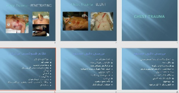 پاورپوينت با عنوان تروما قفسه سینه Chest Trauma