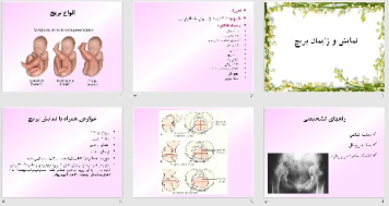 پاورپوينت با عنوان نمایش و زایمان بریچ