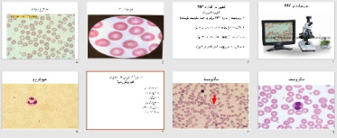 پاورپوينت با عنوان مورفولوژی RBC