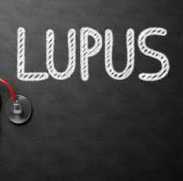 پاورپوینت ارائه بیماری لوپوس (Systemic lupus erythematosus)