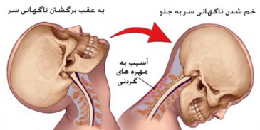 پاورپوینت آسیب های ناحیه گردن