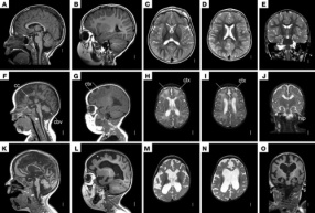 پاورپوینت آماده در مورد روش تصویربرداری MRI از سر و گردن