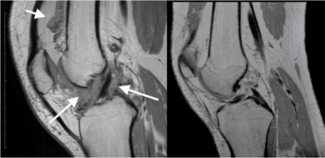 پاورپوینت آماده در مورد روش تصویربرداری MRI از مفاصل