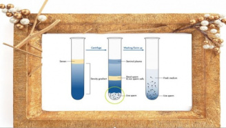 ازمایش تولید مثل مشاهده و شمارش اسپرم