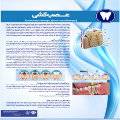 پوستر عصب کشی دندان- مجموعه پوسترهای دندانپزشکی