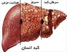 پاورپوینت کبد و بیماری های آن