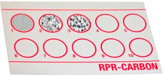 پاورپوینت بیماری سیفلیس و آزمایشهای تشخیصی آن (RPR و VDRL)