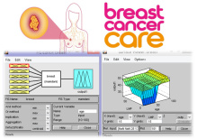 پیاده سازی سیستم فازی-قانونگرا برای پیش بینی سرطان سینه در متلب