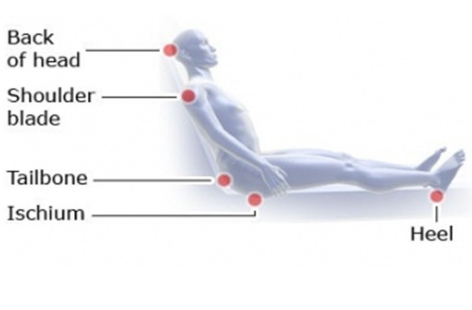 پاورپوینت زخم هاي فشاري یا pressure ulcers