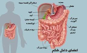 پاورپوینت سندروم روده تحریک پذیر، التهاب اپاندیس، پریتونیت