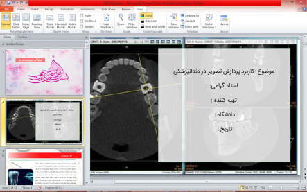 پاورپوینت کاربرد پردازش تصویر در دندانپزشکی (انواع تصویربرداری دندانپزشکی)