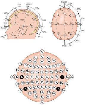 داده EEG آماده افراد مبتلا به تشنج