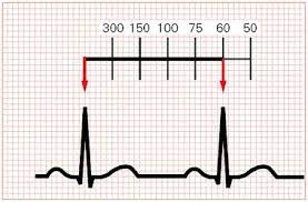 پاورپوینت خصوصیات امواج قلبی در الکتروکاردیوگرام