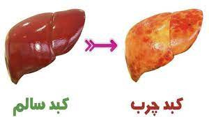 پاورپوینت کبد چرب