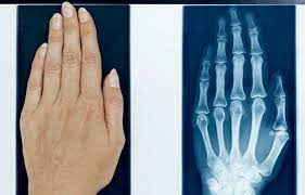 پاورپوینت تاریخچه x-Ray