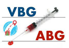 پاورپوینت آزمایش گازهای خونی ABG