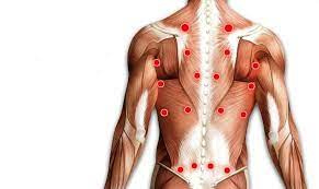 پاورپوینت نقاط ماشه ای گرفتگی عضلات اسپاسم
