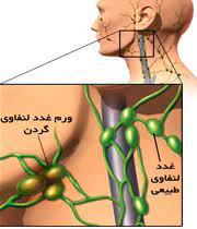 پاورپوینت گره‌های لنفاوی