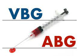 پاورپوینت گاز خون شرياني ABG