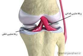 تحقیق پزشکی در فوتبال وقتی رباط صلیبی پاره می شود