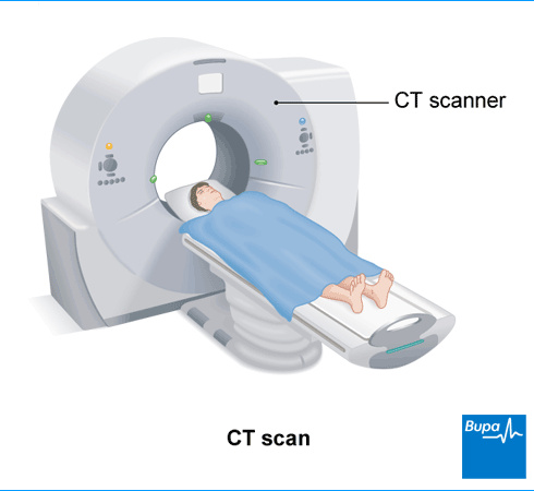 پاورپوینت روش های عکس برداری دستگاه سی تی اسکن (CT SCAN)