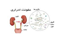 پاورپوینت میکروب شناسی سیستم ادراری