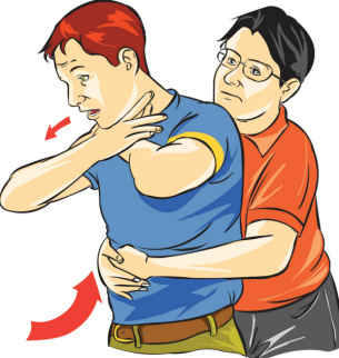 پاورپوینت مانور هايمليخ (HEIMLICH MANEUVER)