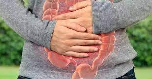 پاورپوینت دستگاه گوارش انسان و گیاهان دارویی رایج در درمان یبوستConstipation